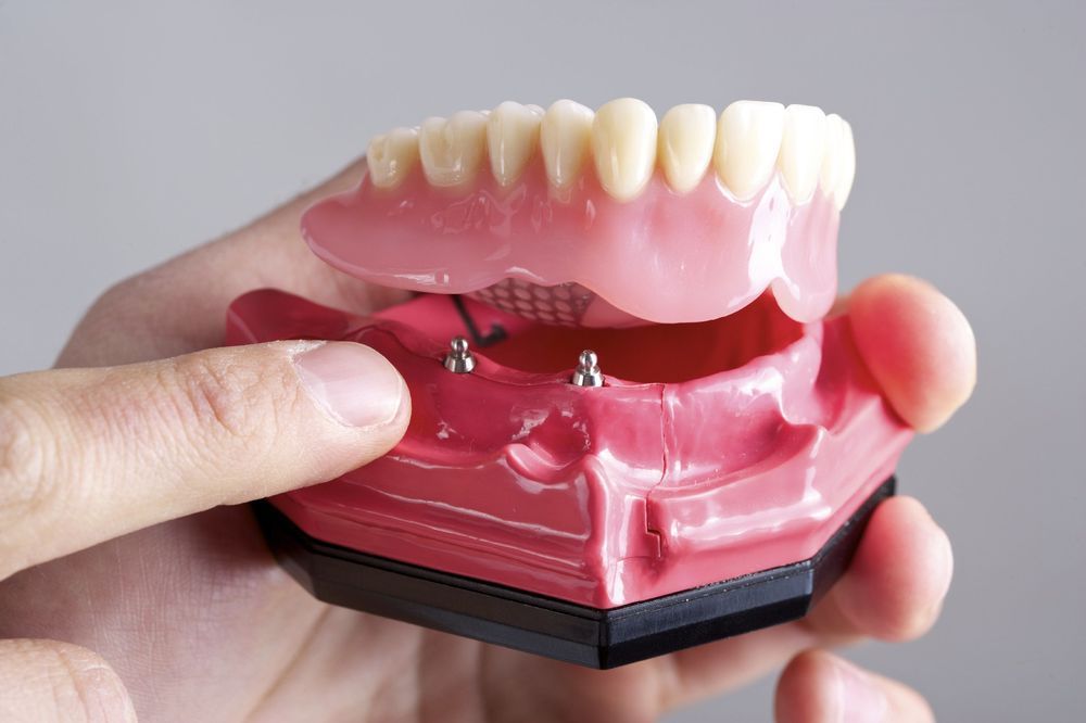 dentures-types-2