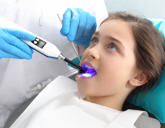 What Are Dental Sealants?